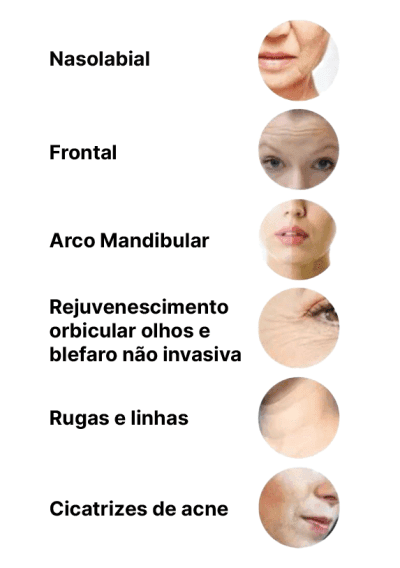 Tratamento facial com Ultramed